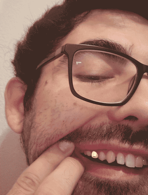 An edited of man with gold tooth